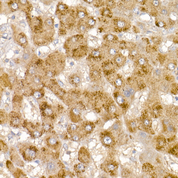 Glycerol kinase (GK) Rabbit pAb
