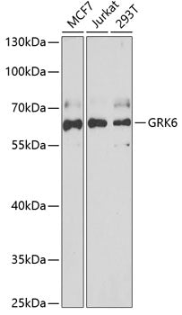 GRK6 Rabbit pAb