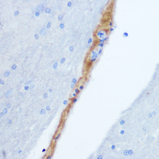 Gastrin Releasing Peptide (GRP) Rabbit pAb