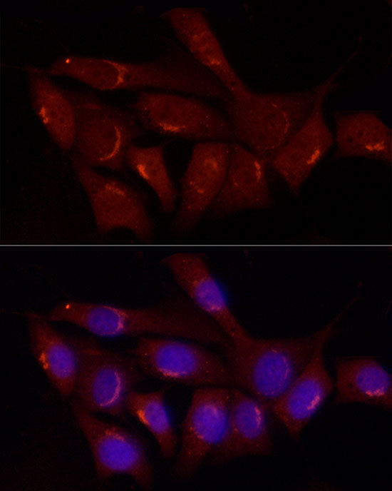 Gastrin Releasing Peptide (GRP) Rabbit pAb