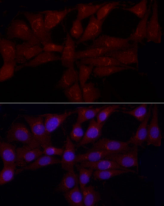 Gastrin Releasing Peptide (GRP) Rabbit pAb