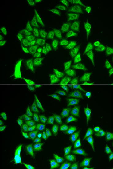IRP2 Rabbit pAb