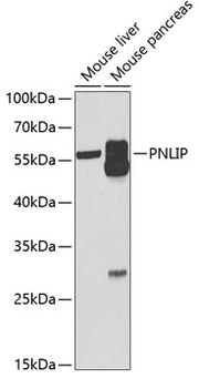 PNLIP Rabbit pAb