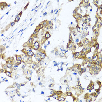 PPOX Rabbit pAb