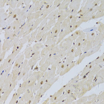 U1A/SNRPA Rabbit pAb