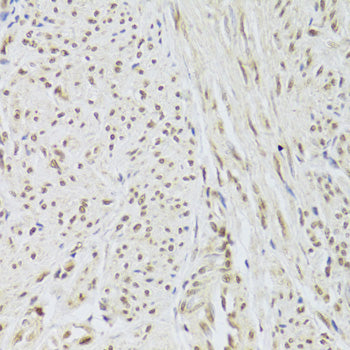 U1A/SNRPA Rabbit pAb