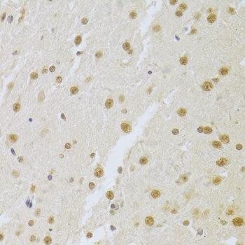 U1A/SNRPA Rabbit pAb