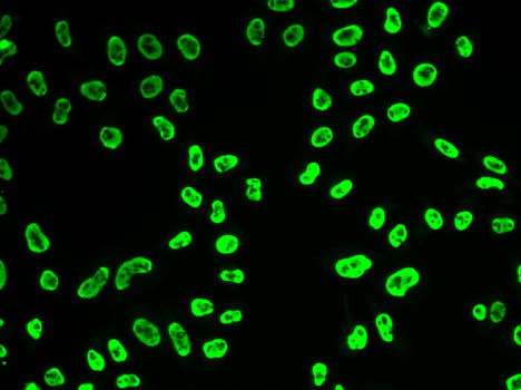 U1A/SNRPA Rabbit pAb
