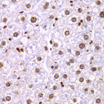 SSRP1 Rabbit pAb