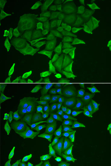 CD84 Rabbit pAb