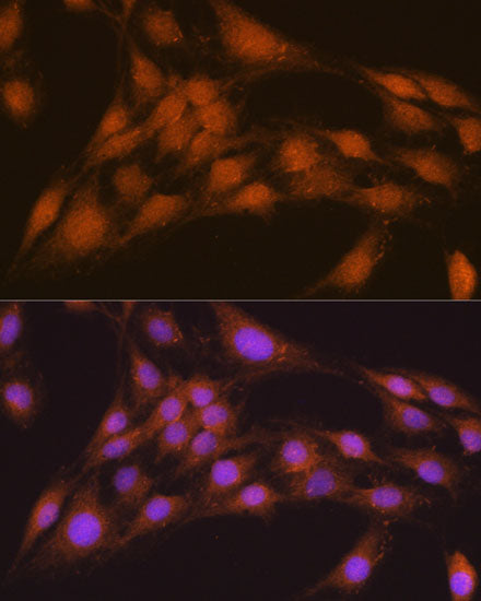 [KO Validated] NRBF2 Rabbit pAb