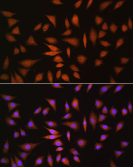 [KO Validated] NRBF2 Rabbit pAb