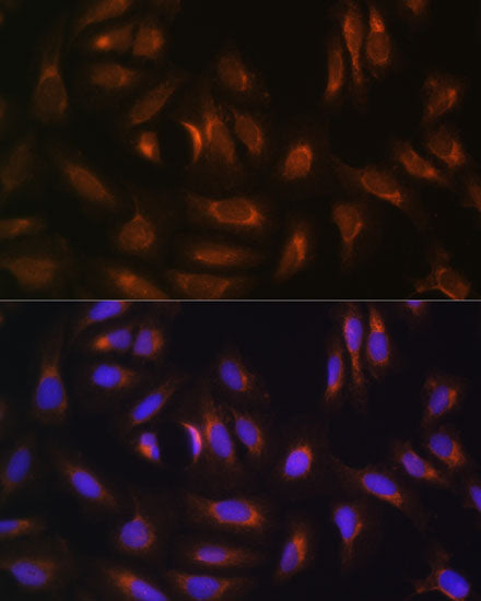[KO Validated] NRBF2 Rabbit pAb