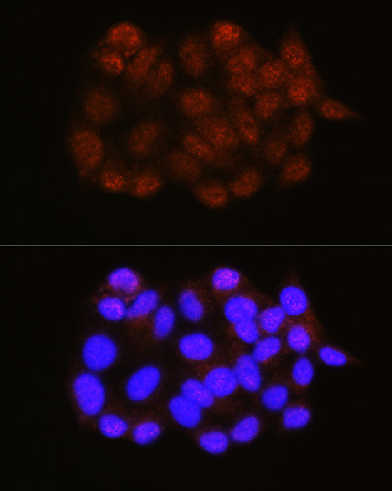 [KO Validated] NRBF2 Rabbit pAb