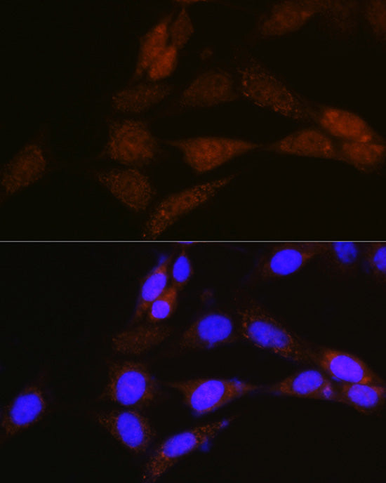 [KO Validated] NRBF2 Rabbit pAb