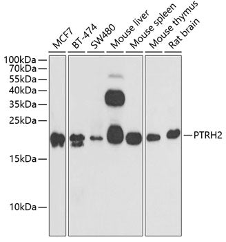 PTRH2 Rabbit pAb