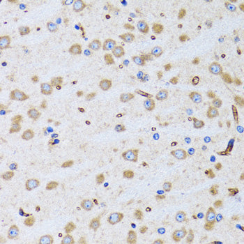 PTRH2 Rabbit pAb