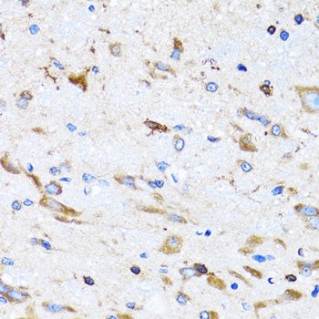 PTRH2 Rabbit pAb