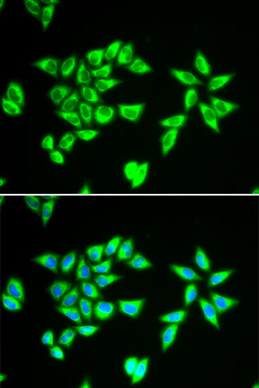 PTRH2 Rabbit pAb
