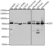 ACSS2 Rabbit pAb