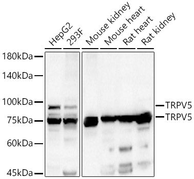 TRPV5 Rabbit pAb
