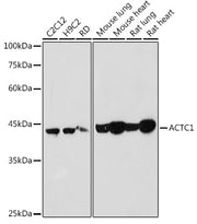 ACTC1 Rabbit pAb