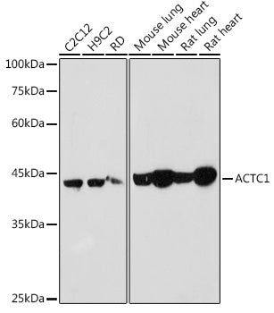ACTC1 Rabbit pAb