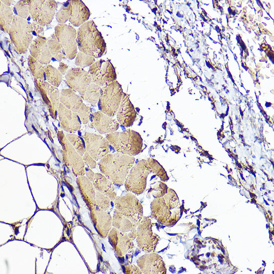 ACTC1 Rabbit pAb