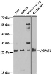 AGPAT1 Rabbit pAb