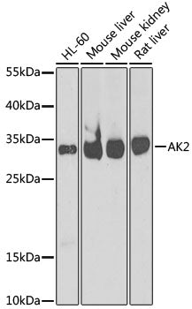 [KO Validated] AK2 Rabbit pAb