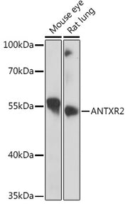 ANTXR2 Rabbit pAb