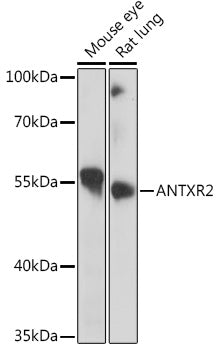 ANTXR2 Rabbit pAb