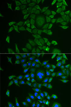 CCBL1 Rabbit pAb