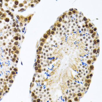 [KO Validated] CIRBP Rabbit pAb