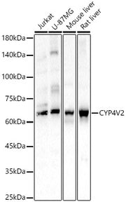 CYP4V2 Rabbit pAb