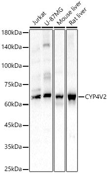 CYP4V2 Rabbit pAb