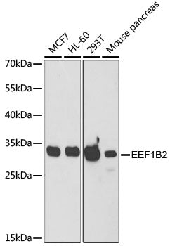 [KO Validated] EEF1B2 Rabbit pAb