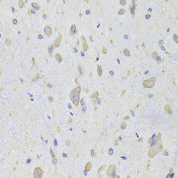 [KO Validated] EEF1B2 Rabbit pAb