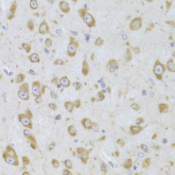 [KO Validated] EEF1B2 Rabbit pAb