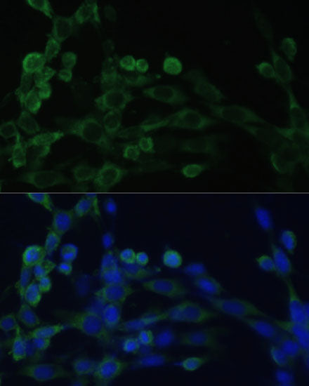 [KO Validated] EEF1B2 Rabbit pAb