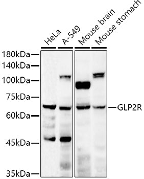 GLP2R Rabbit pAb