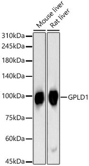 GPLD1 Rabbit pAb