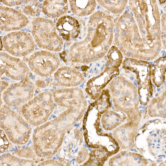 GPLD1 Rabbit pAb