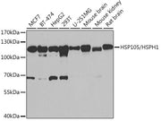 HSP105/HSPH1 Rabbit pAb