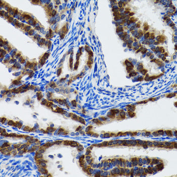 HSP105/HSPH1 Rabbit pAb
