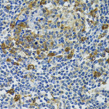HSP105/HSPH1 Rabbit pAb