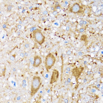 HSP105/HSPH1 Rabbit pAb