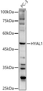 HYAL1 Rabbit pAb