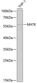 MATK Rabbit pAb