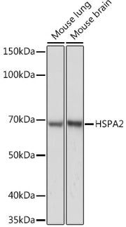 HSPA2 Rabbit mAb